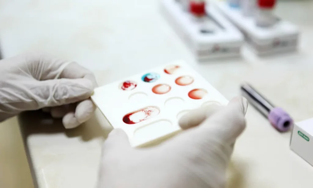 آزمایش خون سریع و ارزانی که ممکن است سرطان را.webp