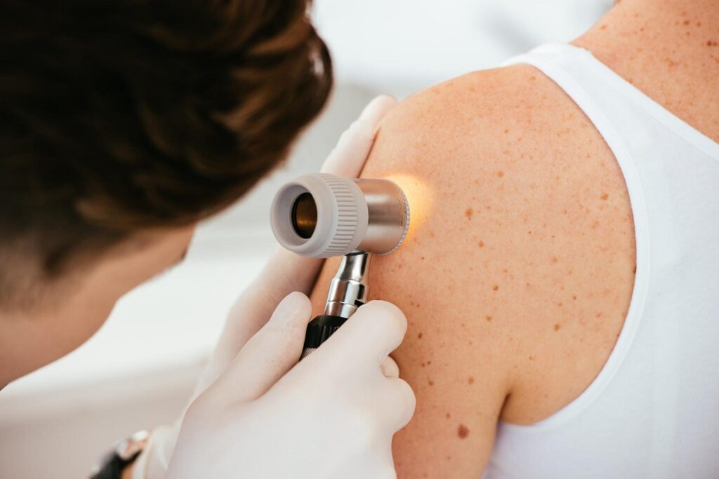 درمان mRNA مدرنا ریسک مرگ در مبتلایان به سرطان پوست را به نصف رساند