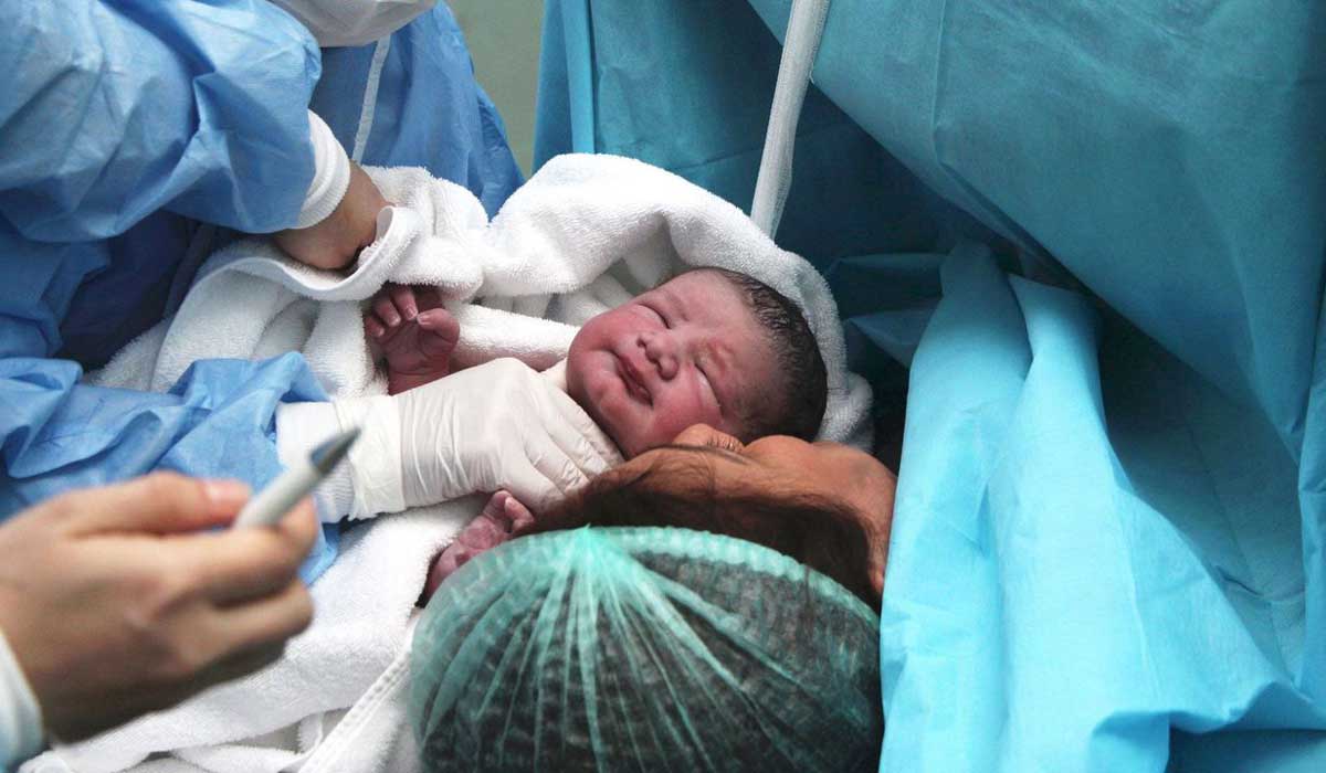 انتخاب روش زایمان