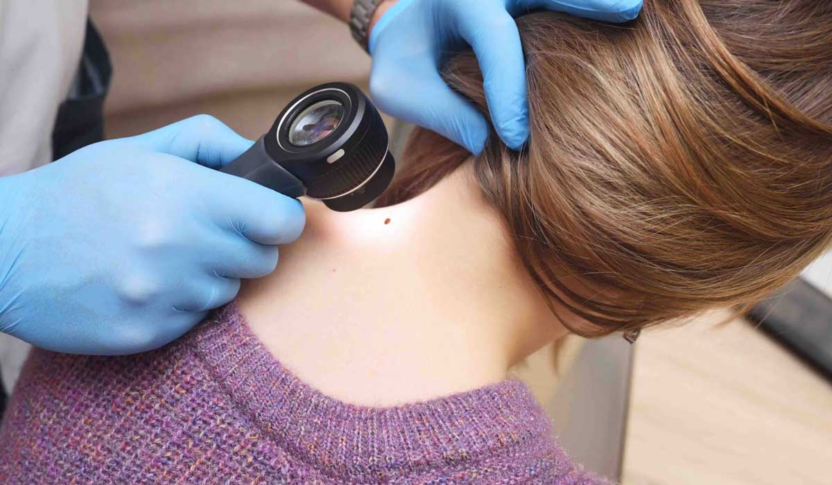 دکتر پوست کیست