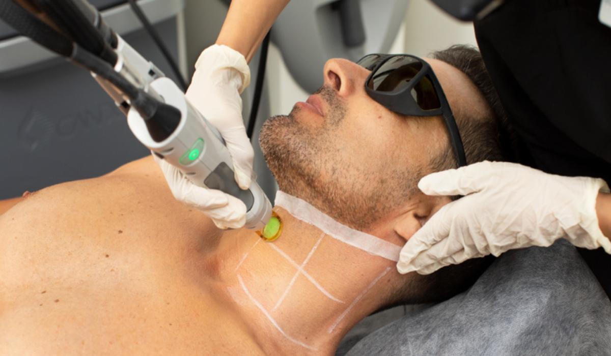 لیزر موهای زائد | مزایا، انواع و قیمت لیزر موهای زائد_رنگو 22 مراکز لیزر موهای زائد چه موارد ایمنی را باید رعایت کنند