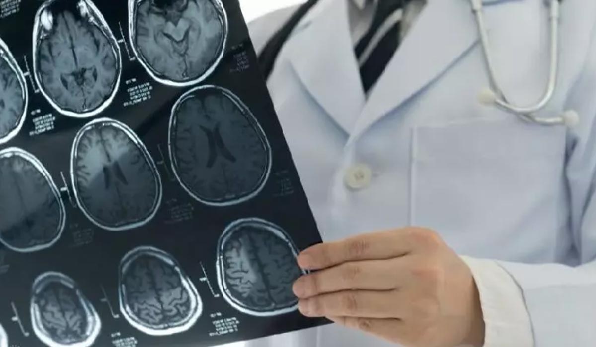 دکتر نورولوژی کیست؟