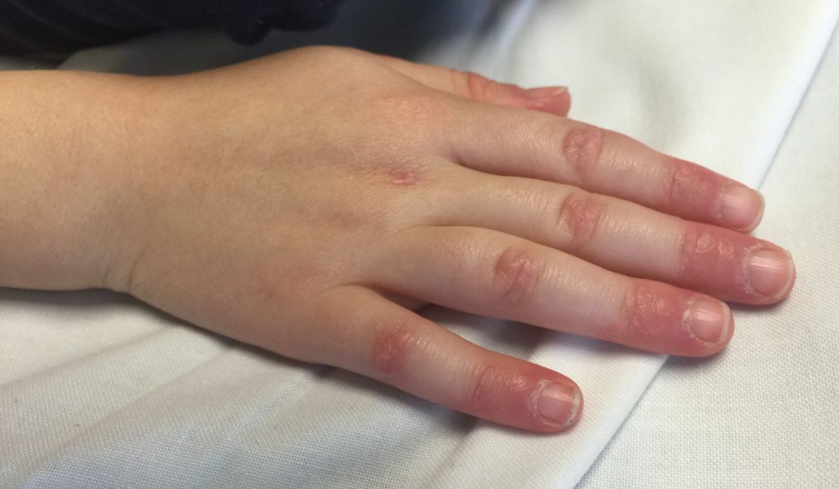 تخصص پزشکی ورزشی چیست و دکتر طب ورزشی کیست؟ ماموریت های دکتر ورزشی_رنگو 23 پیشگیری از بیماریهای مزمن