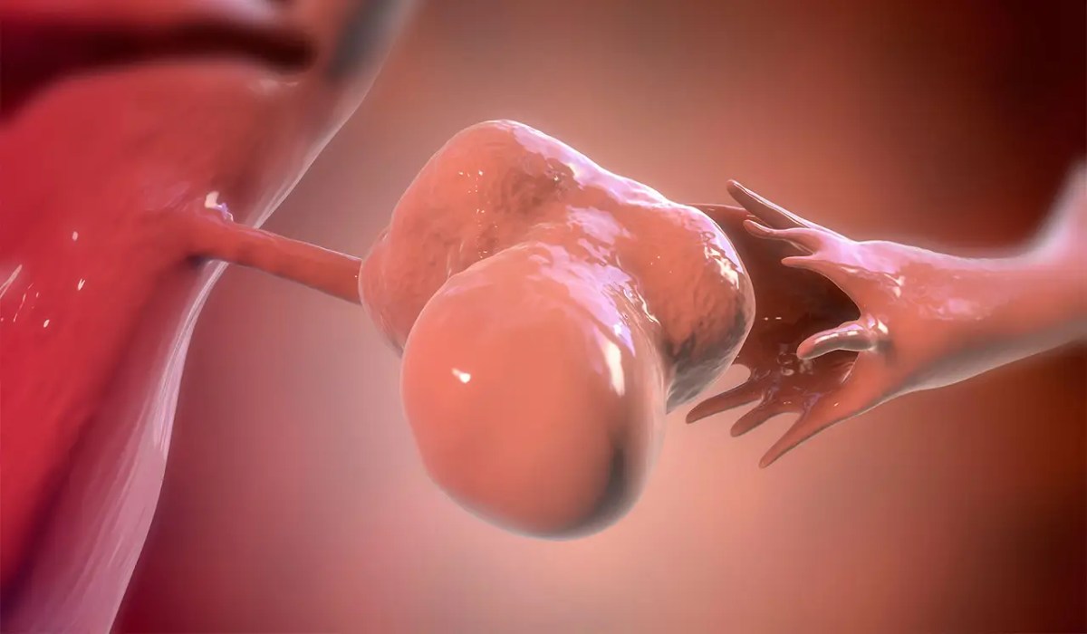 تخصص غدد چیست و دکتر غدد چیست؟ آشنایی بادکتر متابولیسم_رنگو 14 سندرم تخمدان پلیکیستیک