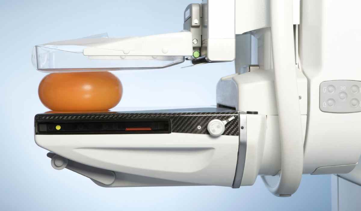 ماموگرافی چیست