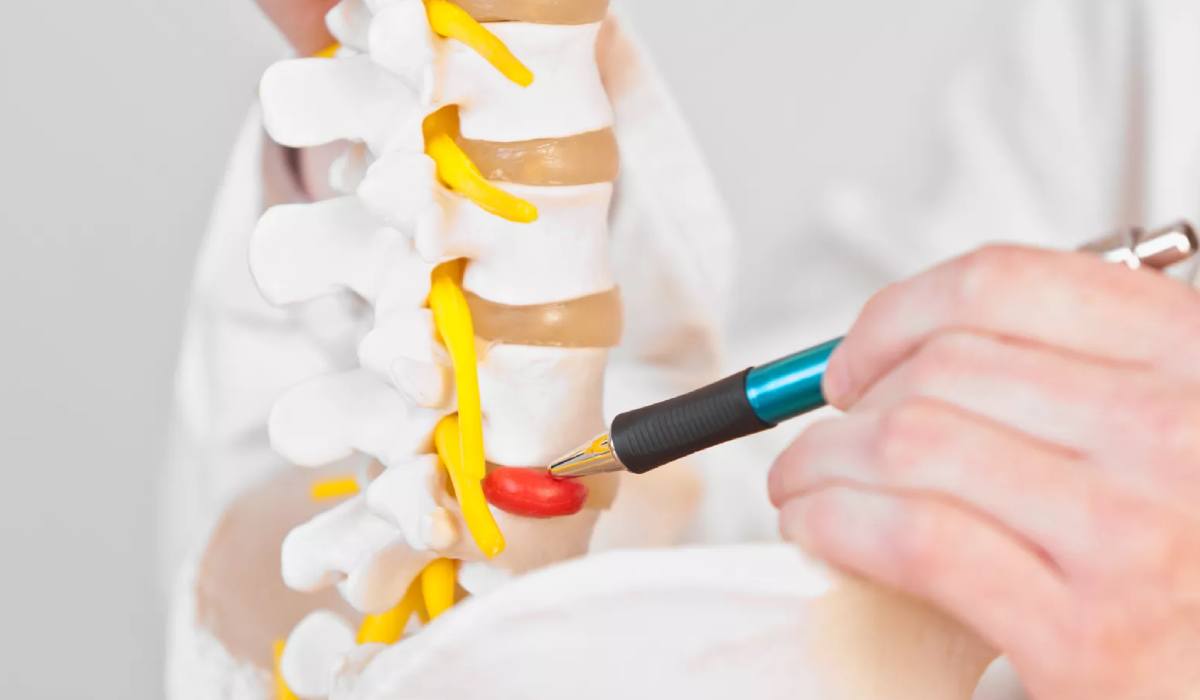 درمان های غیر جراحی دیسک_رنگو 16 برای درمان جراحی بدون دیسک به کدام دکتر مراجعه کنیم؟