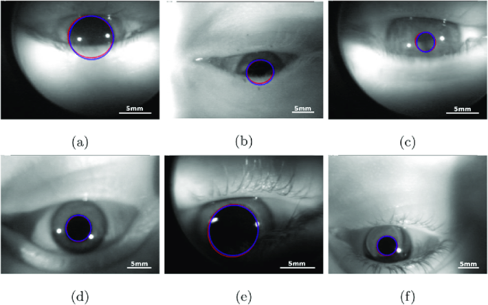 تصویر آزمایش سنجش اندازه مردمک چشم