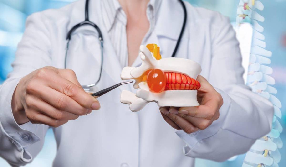 درمان های غیر جراحی دیسک_رنگو 12 درمان های بدون جراحی دیسک