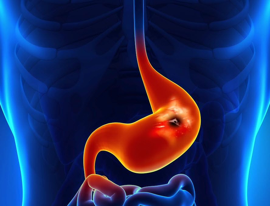 مدفوع سیاه و قیری رنگ