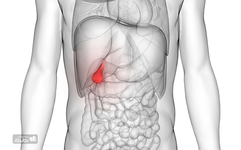 درمان سنگ صفرا با طب سنتی_رنگو 36 درمان سنگ صفرا