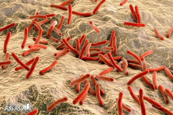 همه چیز درمورد بیماری جذام از علت و علائم تا راههای تشخیص و درمان آن_رنگو 14 باکتری بیماری جذام
