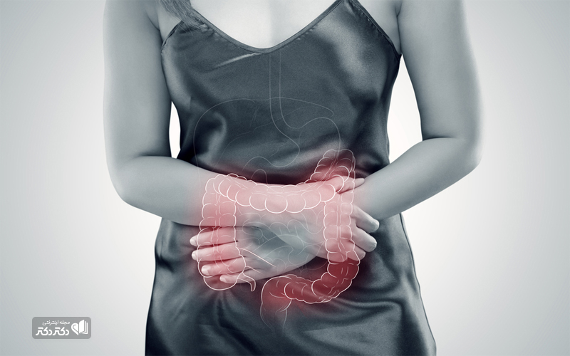 درمان کولیت