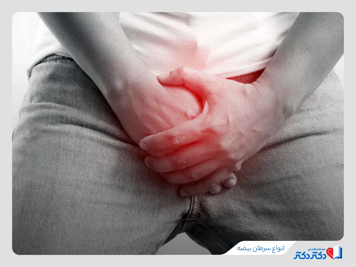 سرطان بیضه چیست و چه علائمی دارد؟ معارفه روش های تشخیص و درمان_رنگو 36 تشخیص انواع سرطان بیضه