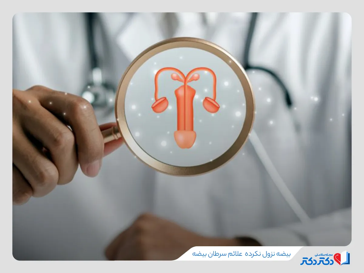 سرطان بیضه چیست و چه علائمی دارد؟ معارفه روش های تشخیص و درمان_رنگو 38 بیضه نزول نکرده یکی از علل سرطان بیضه