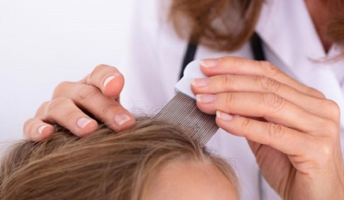 بهترین شامپوهای ضد شپش + داروهای تجویزی و بدون نسخه شپش_رنگو 24 بهترین شامپوهای ضد شپش