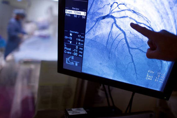 توسعه موفقیت‌آمیز لوله قلبی هوشمند با قابلیت تنظیم خودکار