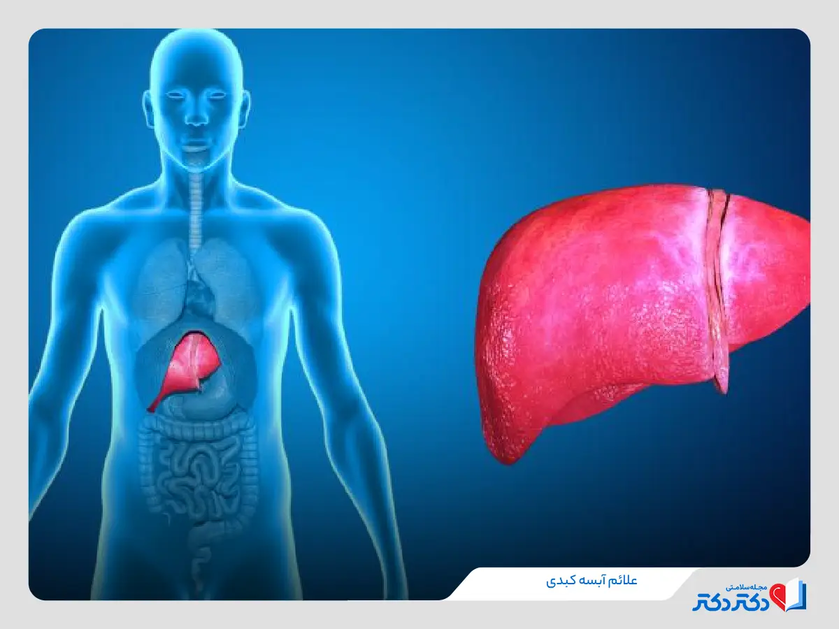 آبسه کبدی چیست و چه علائمی دارد؟ + بازدید دلایل عفونت کبدی_رنگو 18 علت و علائم آبسه کبدی