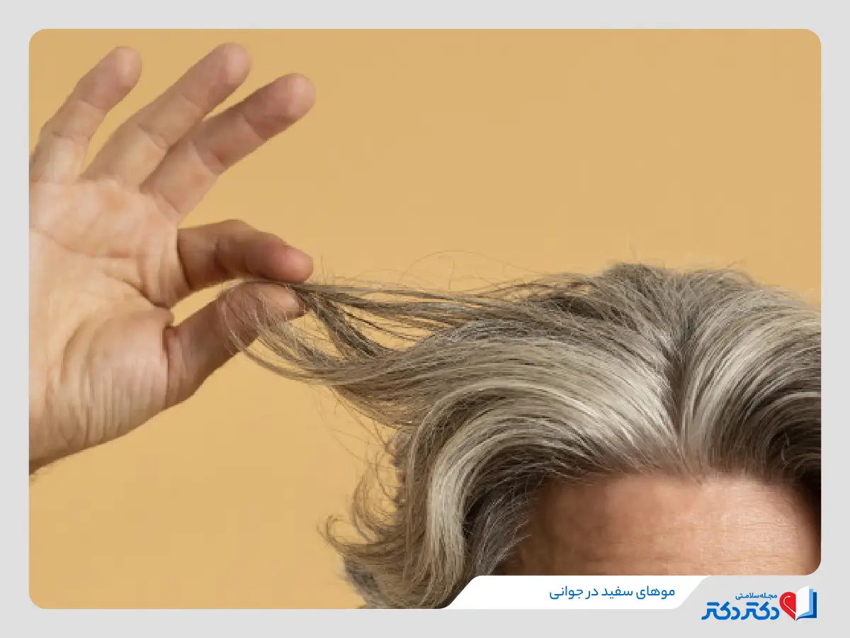 سفیدی مو در جوانی