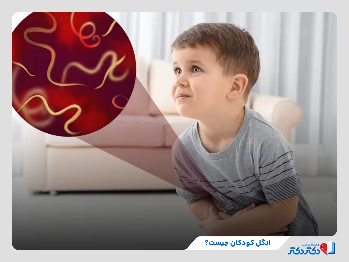 انگل کودکان چیست و چه علائمی دارد؟ + راه حلهای پیشگیری_رنگو 2 انگل کودک، از شایعترین بیماریهای کودکان