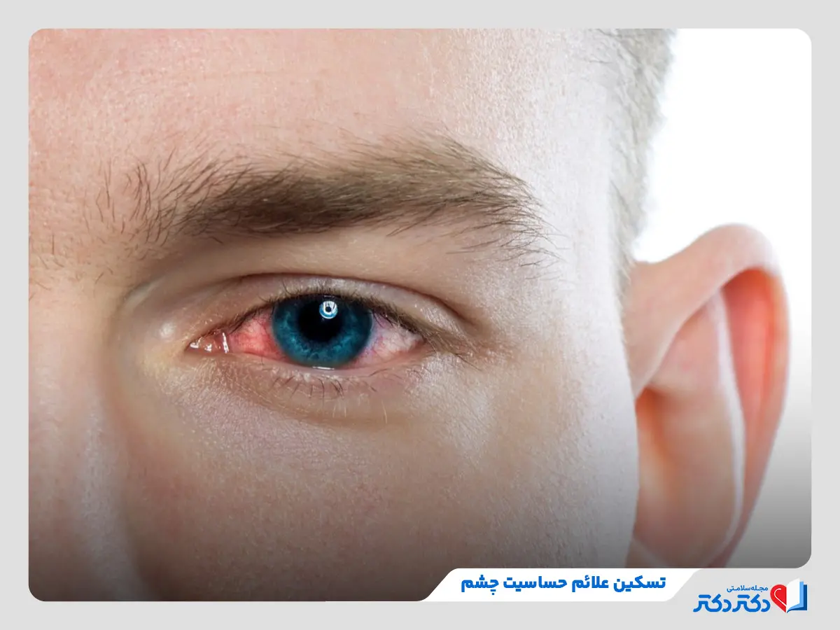 قطره نفازولین چشمی چیست و برای چه مواردی منفعت گیری میبشود؟_رنگو 26 تسکین علائم سوزش چشم ناشی از حساسیت یا تحریکاتی مانند گرد و غبار