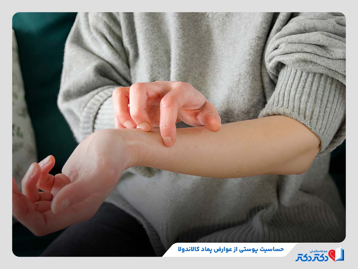 پماد کالاندولا چیست و چه کاربردی دارد؟_رنگو 22 حساسیت پوستی، خارش و واکنشهای درماتیتی از عوارض پماد کالاندولا