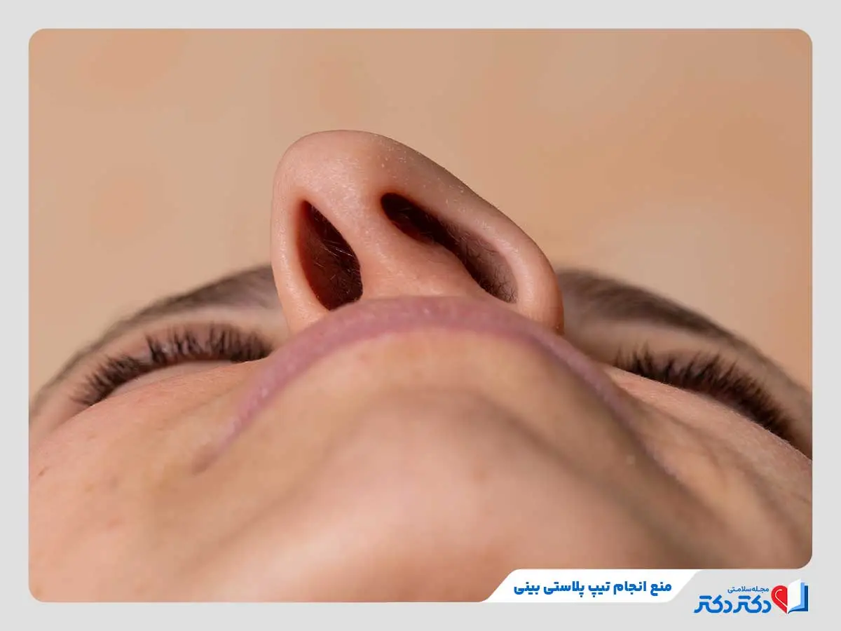 تیپ پلاستی بینی چیست؟ + انواع، مزایا و عوارض جراحی نوک بینی_رنگو 24 تیپ پلاستی بینی انتخابی نامناسب برای انحراف شدید تیغه بینی