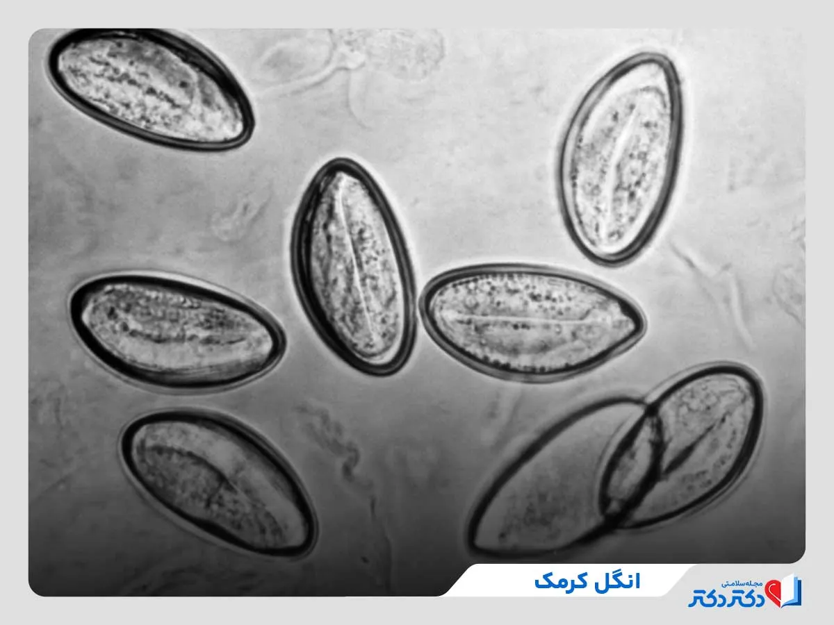 انگل کودکان چیست و چه علائمی دارد؟ + راه حلهای پیشگیری_رنگو 6 کرمک، از شایعترین نوع انگل کودکان
