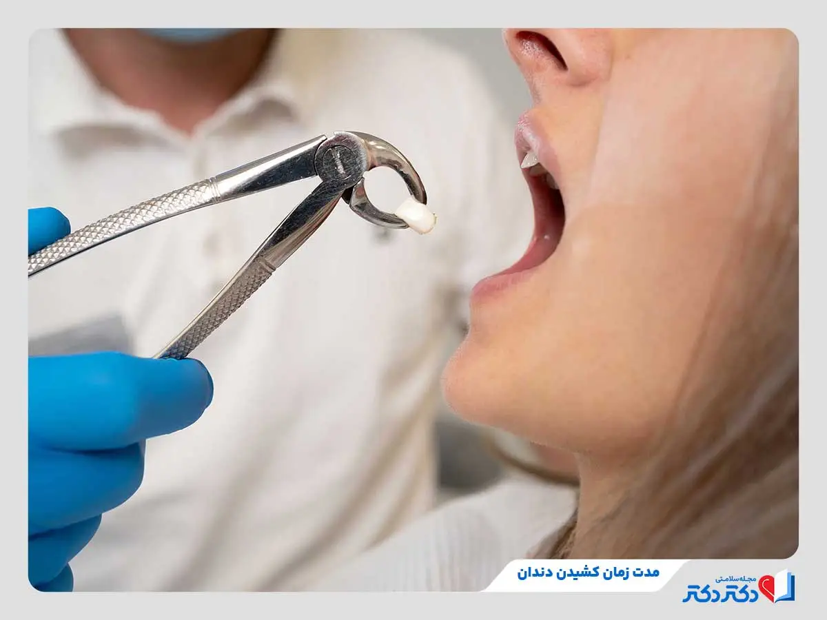 کشیدن دندان چه وقتی الزام اشکار میکند؟ + مرحله های کشیدن دندان_رنگو 10 مدتزمان کشیدن دندان بهطورمعمول بین 5 تا 10 دقیقه طول میکشد.
