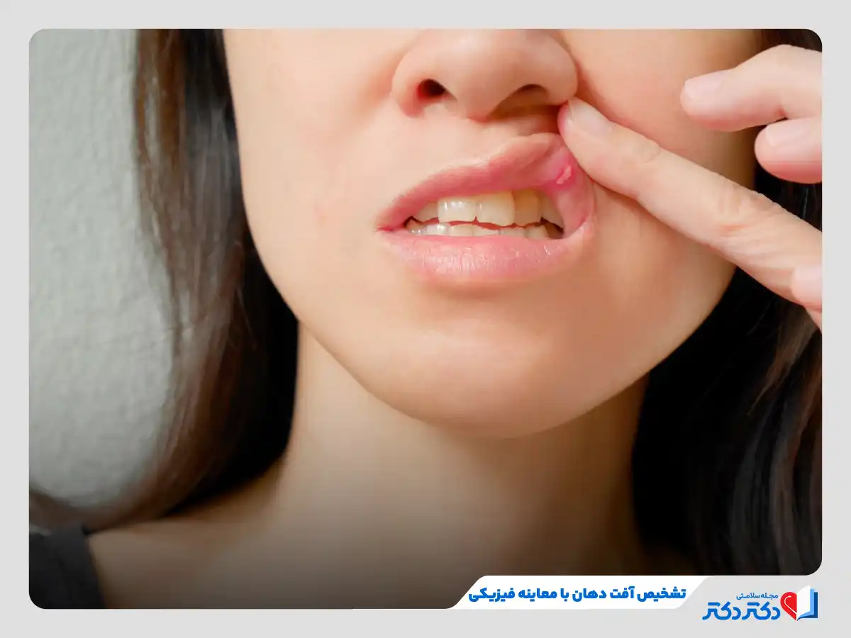آفت دهان چیست و چه علتی دارد؟ + راه حلهای درمان آفت دهان_رنگو 24 تشخیص آفت دهان با معاینه فیزیکی