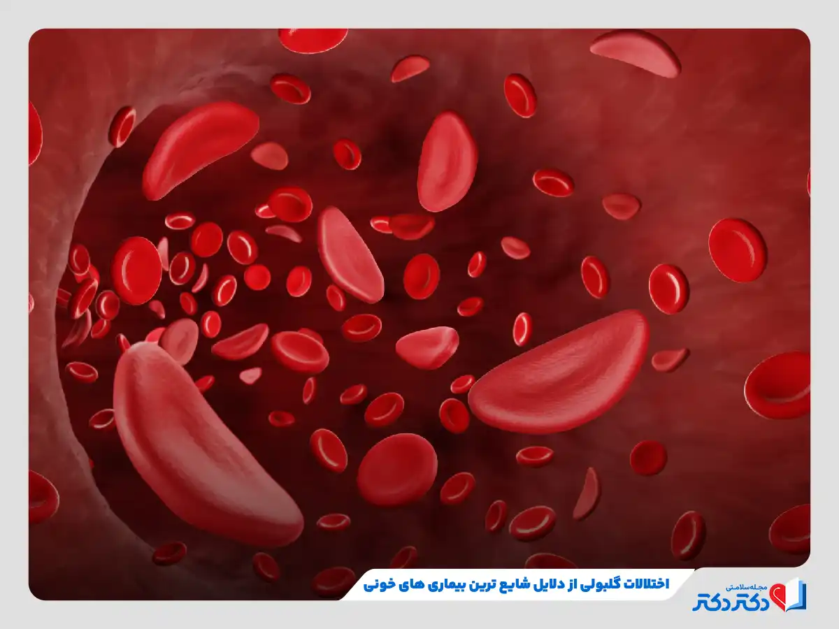 بیماری های خونی متداول را بشناسید!_رنگو 14 اختلالات گلبولی از دلایل شایع ترین بیماری های خونی
