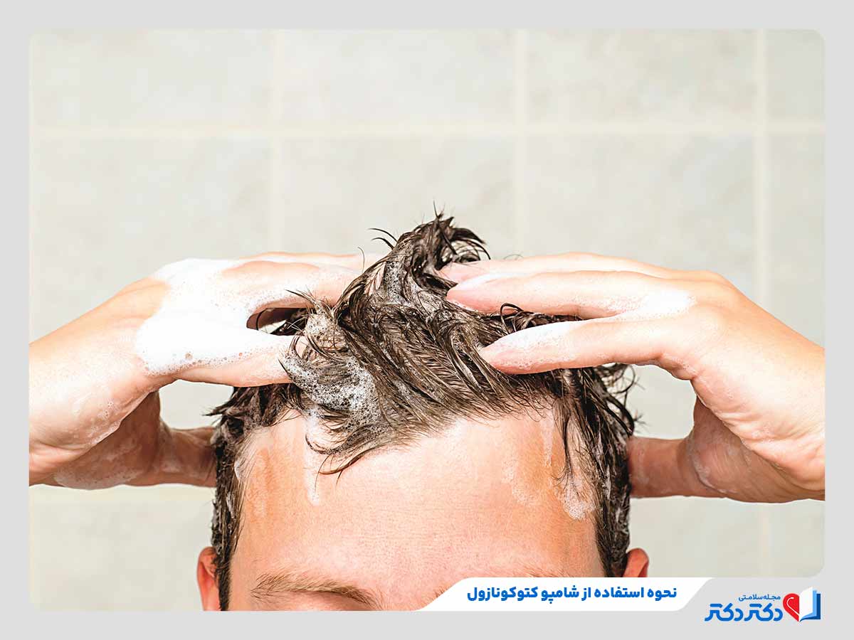 شامپو کتوکونازول چیست؟ بازدید انواع گوناگون این دارو + عوارض_رنگو 12 نحوه شستن موها با شامپو کتوکونازول