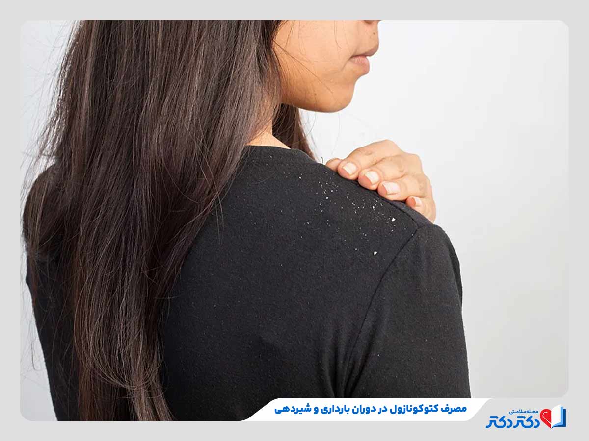 شامپو کتوکونازول چیست؟ بازدید انواع گوناگون این دارو + عوارض_رنگو 14 مشکلات مصرف داروی کتوکونازول در بارداری یا شیردهی
