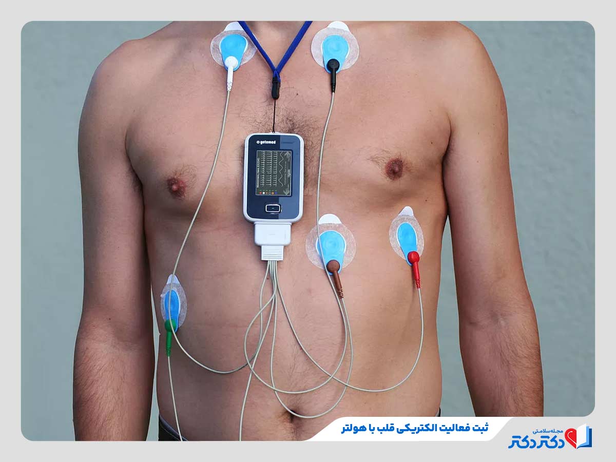 نوار قلب و تفسیر انواع آن + نحوه گرفتن تست الکتروکاردیوگرام_رنگو 44 ارزیابی سیگنالهای الکتریکی قلب در طول یک الی دو شبانهروز با هولتر