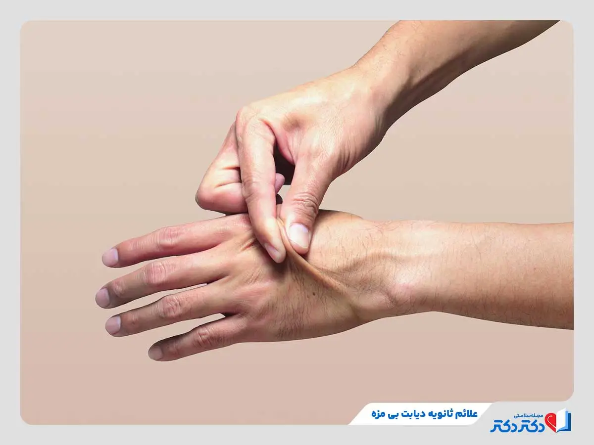 دیابت بی مزه چیست؟ آیا دیابت بی مزه درمان قطعی دارد؟_رنگو 22 تغییر خاصیت ارتجاعی پوست در دیابت بی مزه به دلیل کمآبی بدن