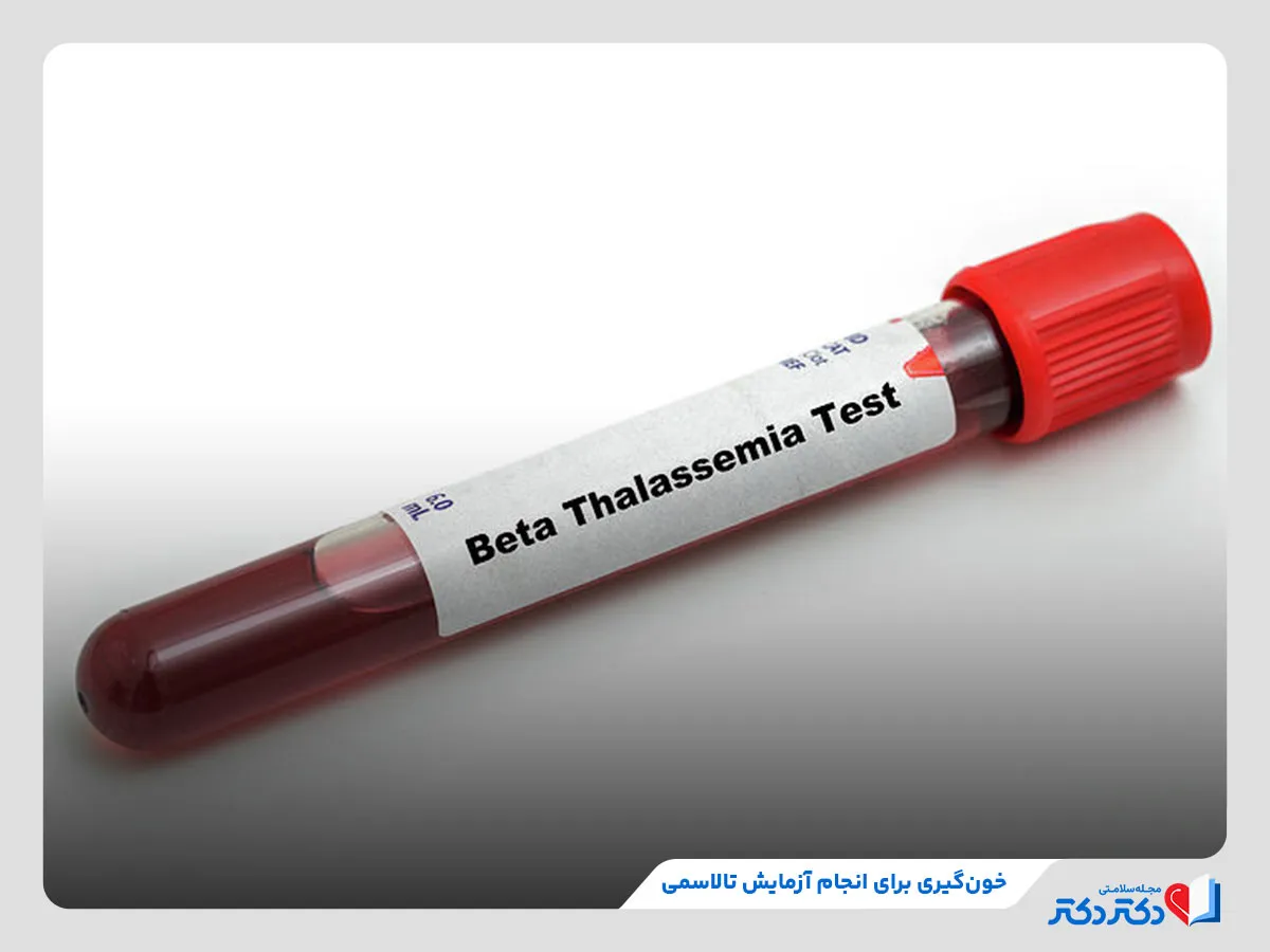 راهنمای کامل آزمایش های قبل ازدواج + انواع و هزینه_رنگو 30 بررسی ابتلای زوجین به بیماری تالاسمی با آزمایش خون