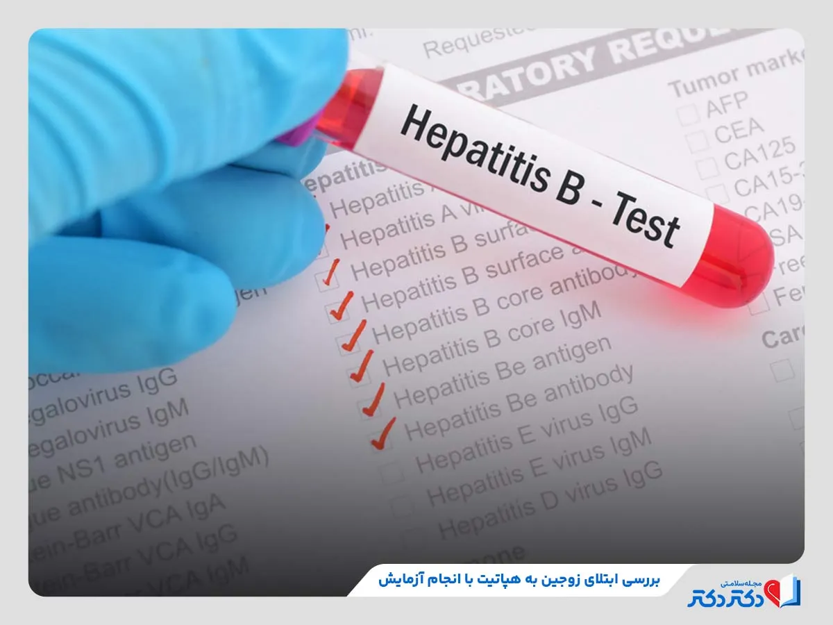 راهنمای کامل آزمایش های قبل ازدواج + انواع و هزینه_رنگو 26 آزمایش هپاتیت b، یکی از مهمترین آزمایشهای قبل از ازدواج برای تشخیص ویروس هپاتیت b