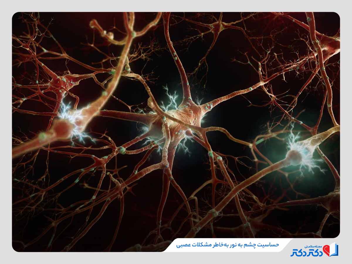 حساسیت چشم به نور چیست؟ بازدید همه علل، علائم و درمانها_رنگو 32 حساسیت چشم به نور خورشید بهدلیل مشکلات عصبی