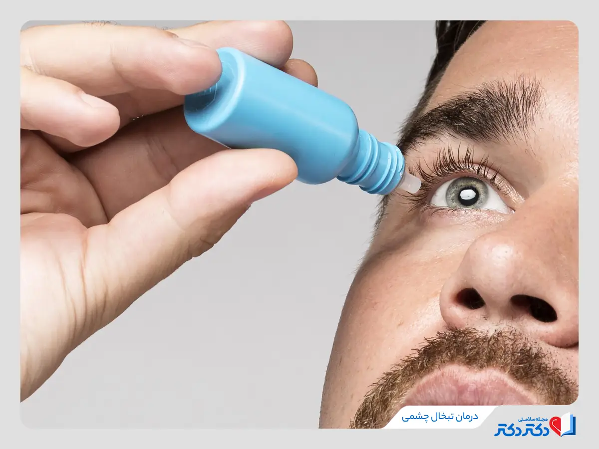 راهنمای کامل تشخیص و درمان تبخال چشمی + معارفه روش درمان آن_رنگو 14 درمان تبخال چشمی به کمک قطرههای چشمی