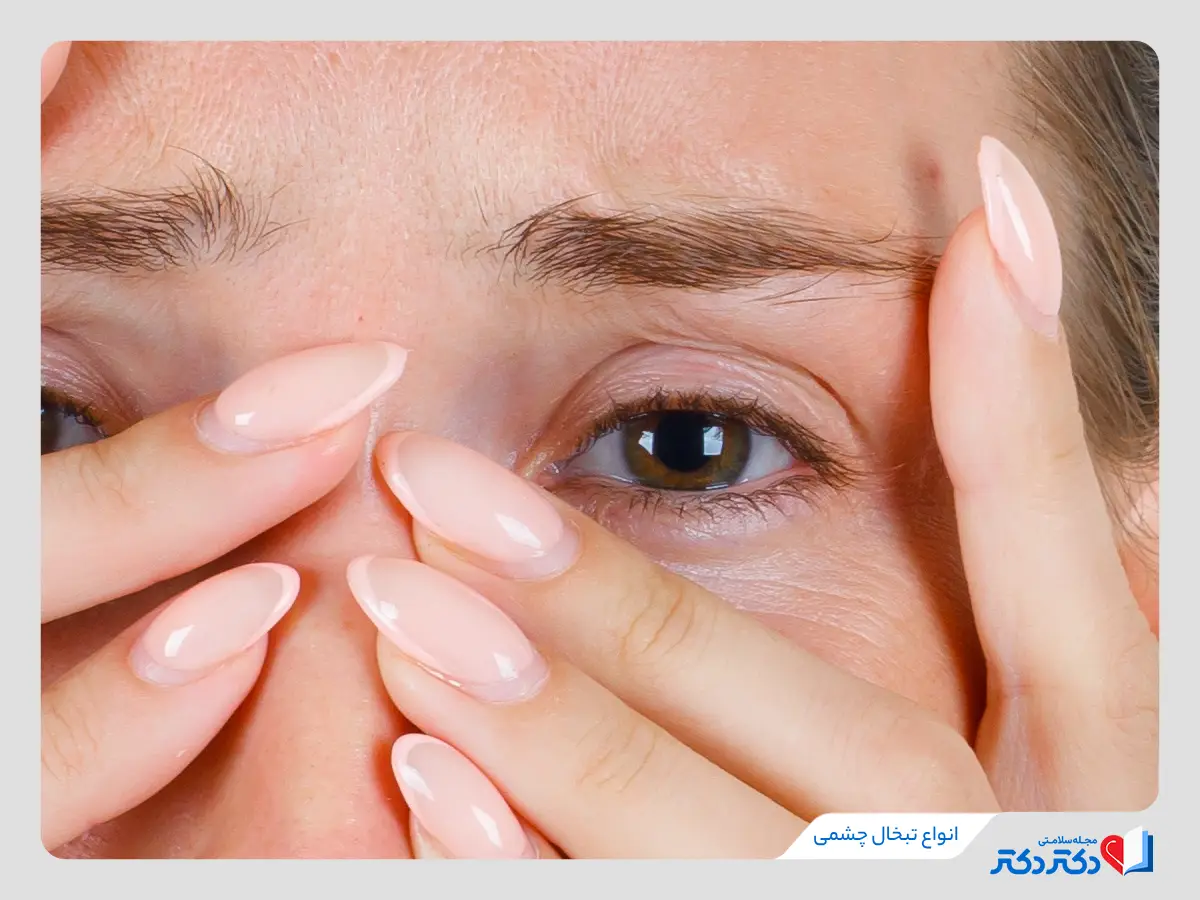 معرفی انواع تبخال چشمی- یک زن نگران از تشخیص نوع تبخال چشمی
