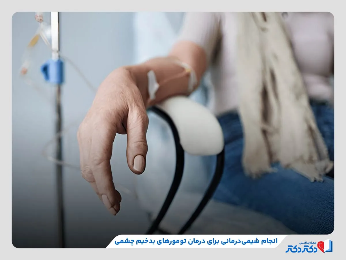 انواع تومور چشمی + بازدید راه حلهای درمانی موثر_رنگو 38 شیمیدرمانی، یکی از روشهای درمانی غیرجراحی برای درمان تومور چشم