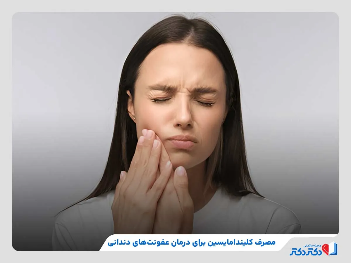 قرص کلیندامایسین | بهترین دارو برای درمان عفونت_رنگو 32 درمان عفونتهای دندانی، یکی از کاربردهای داروی کلیندامایسین