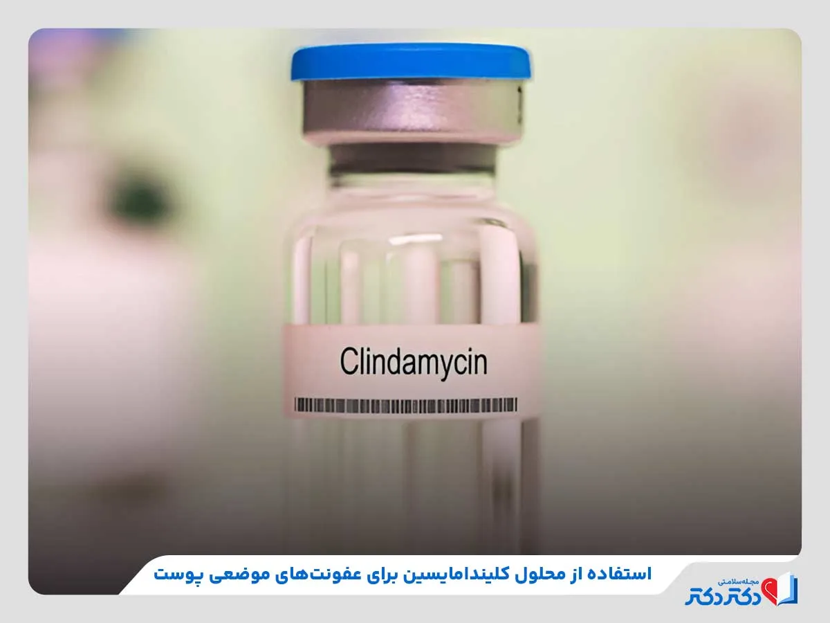 قرص کلیندامایسین | بهترین دارو برای درمان عفونت_رنگو 4 استفاده از ژل و محلول کلیندامایسین برای درمان عفونتهای موضعی پوست