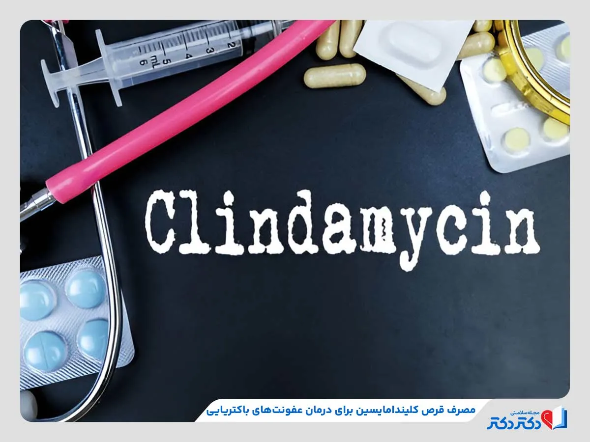قرص کلیندامایسین | بهترین دارو برای درمان عفونت_رنگو 28 داروی کلیندامایسین، موثر در درمان عفونتهای باکتریایی