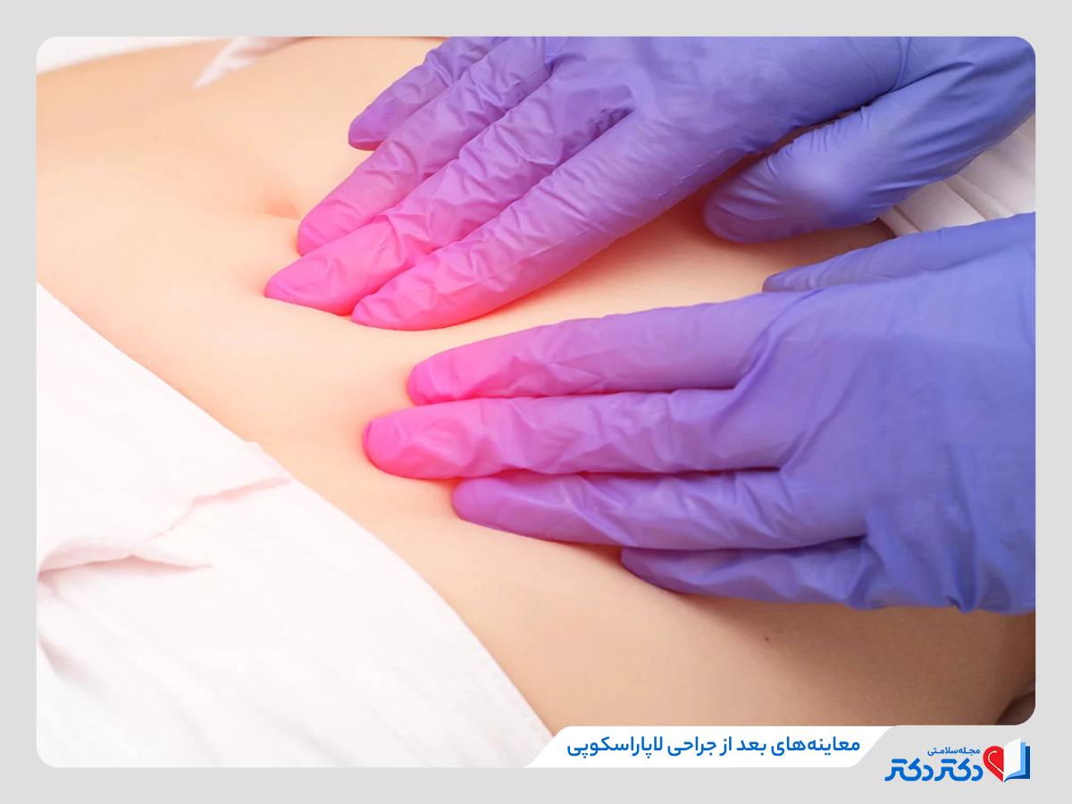 لاپاراسکوپی رحم چطور انجام میبشود؟ تایید شده توسط دکتر زنان_رنگو 8 معاینه های بعد از لاپاراسکوپی رحم