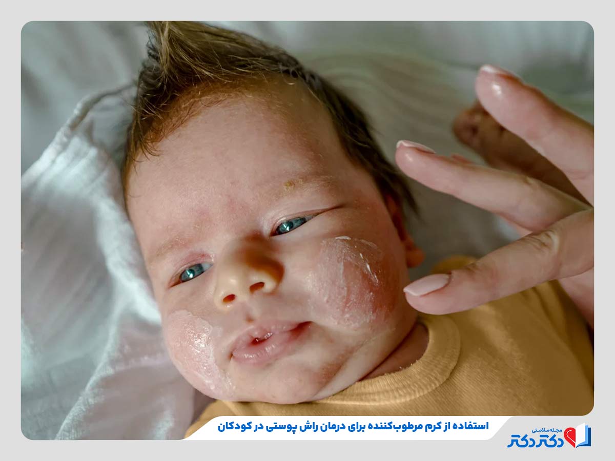 بثورات پوستی کودکان - بازدید دلایل، علائم، انواع و درمان_رنگو 26 مرطوب کردن پوست کودک مبتلا به راش پوستی