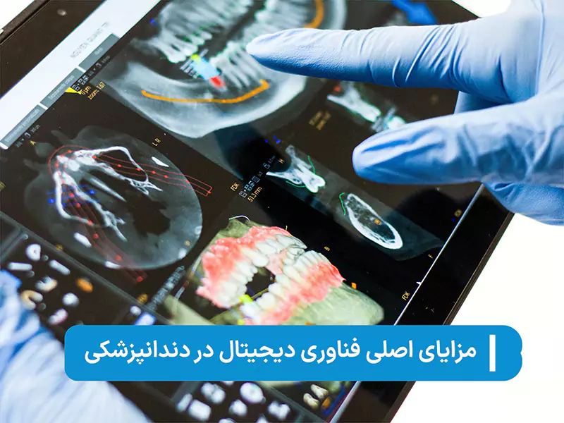 ایمپلنت دیجیتال و سریع: آیندهای بدون درد و با دقت بینظیر_رنگو 2 مزایای ایمپلنت دیجیتال