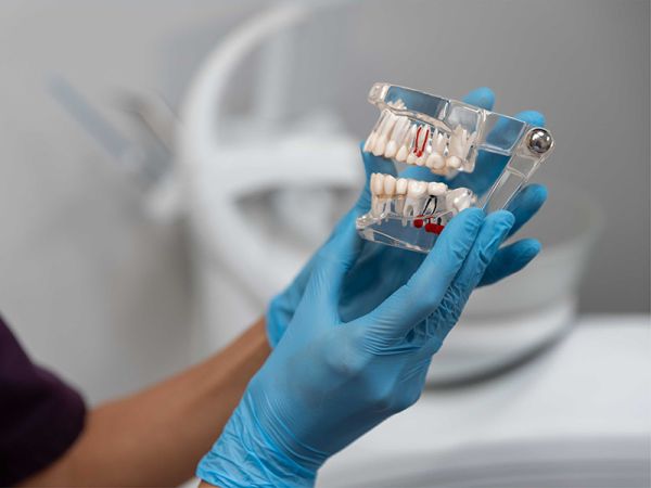 ایمپلنت دیجیتال