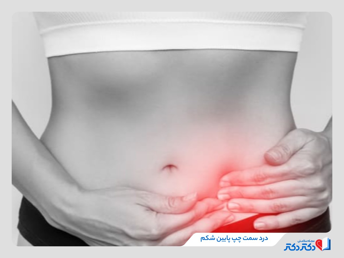 درد سمت چپ پایین شکم چه دلیلی دارد؟ + علائم و درمان_رنگو 20 درد سمت چپ پایین شکم در بانوان