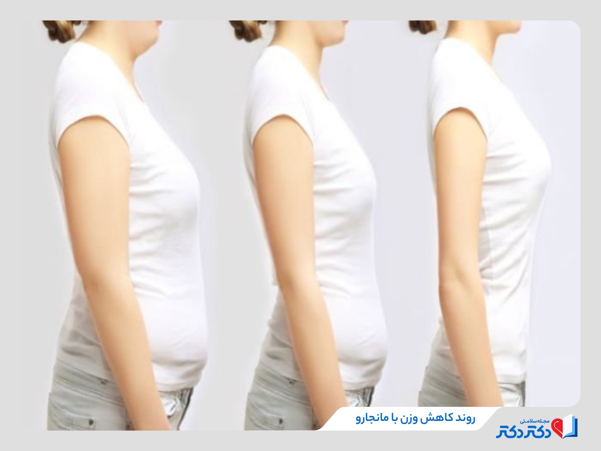 تاثیر آمپول مانجارو روی کاهش وزن یک خانم