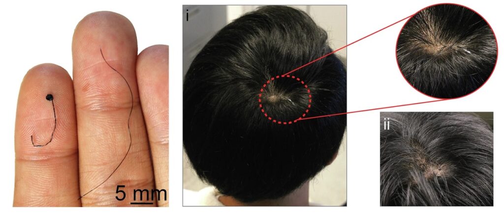 الکترود شبیه به مو